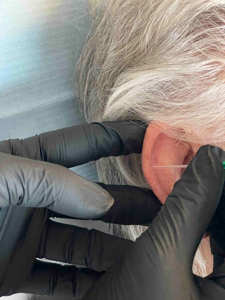 De nazorg bij een medische piercing